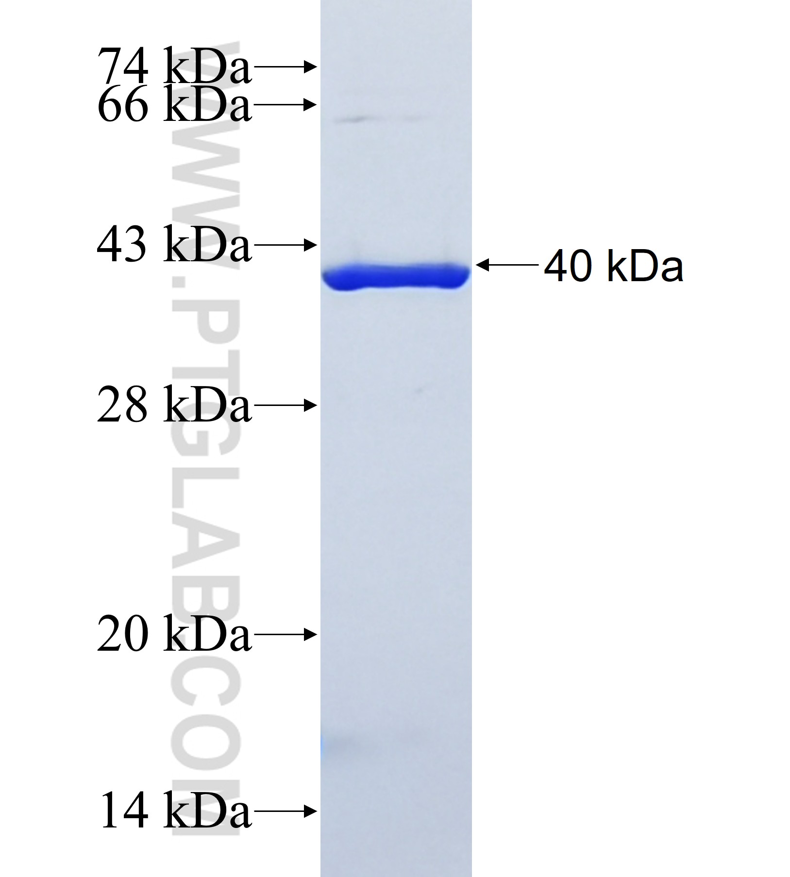 FOXD2 fusion protein Ag41978 SDS-PAGE FOXD2 fusion protein Ag41978 SDS-PAGE