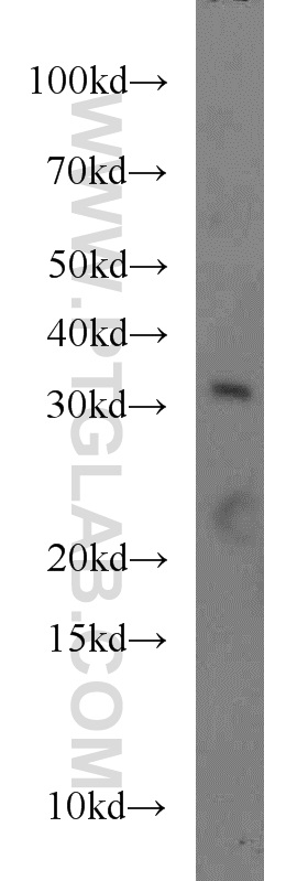 WB analysis of HepG2 using 55301-1-AP