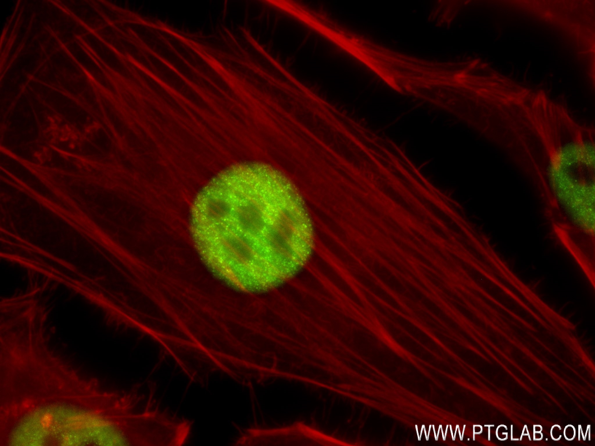 IF Staining of HeLa using 84020-3-RR (same clone as 84020-3-PBS)