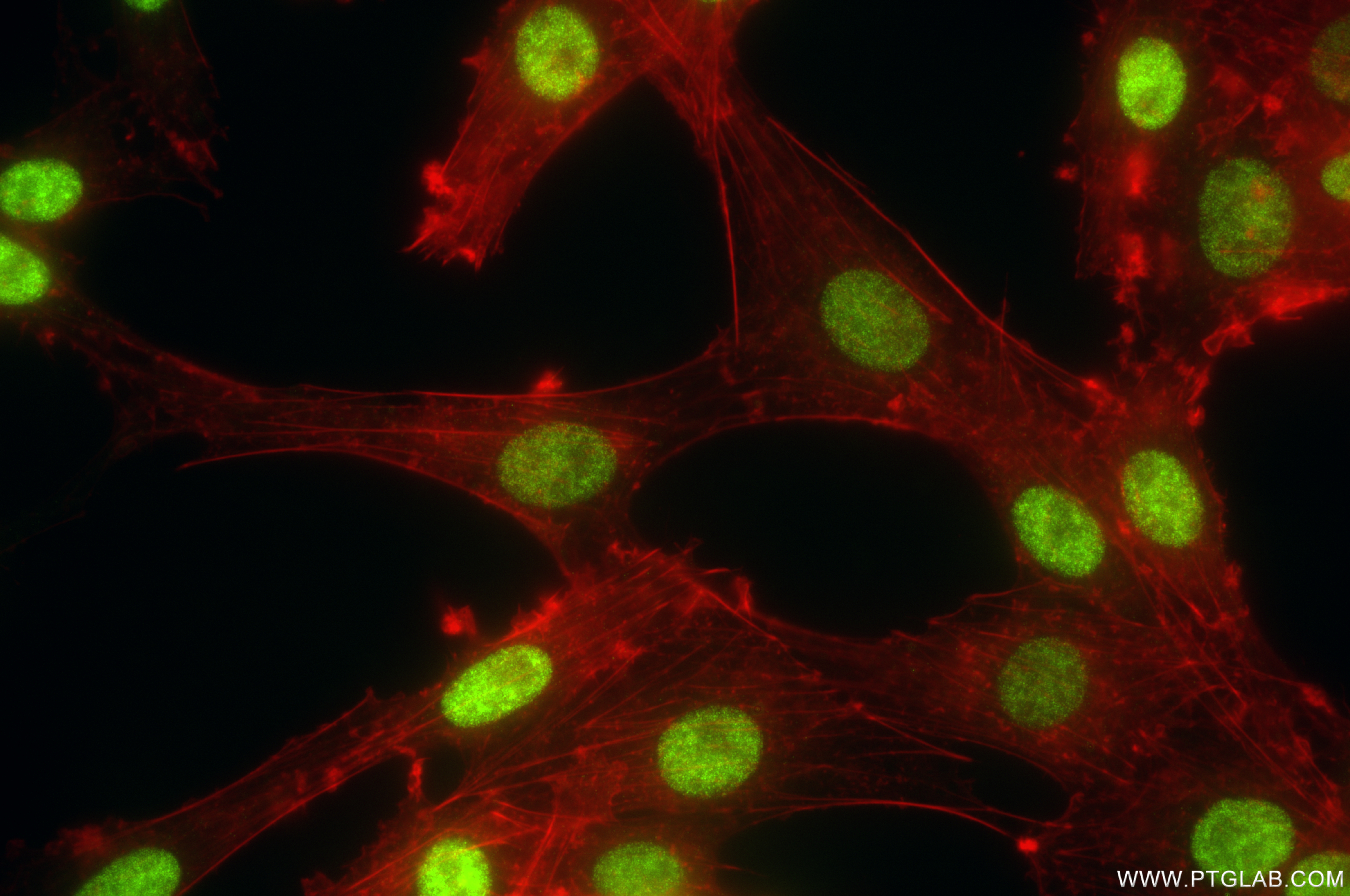IF Staining of C6 using 85930-1-RR