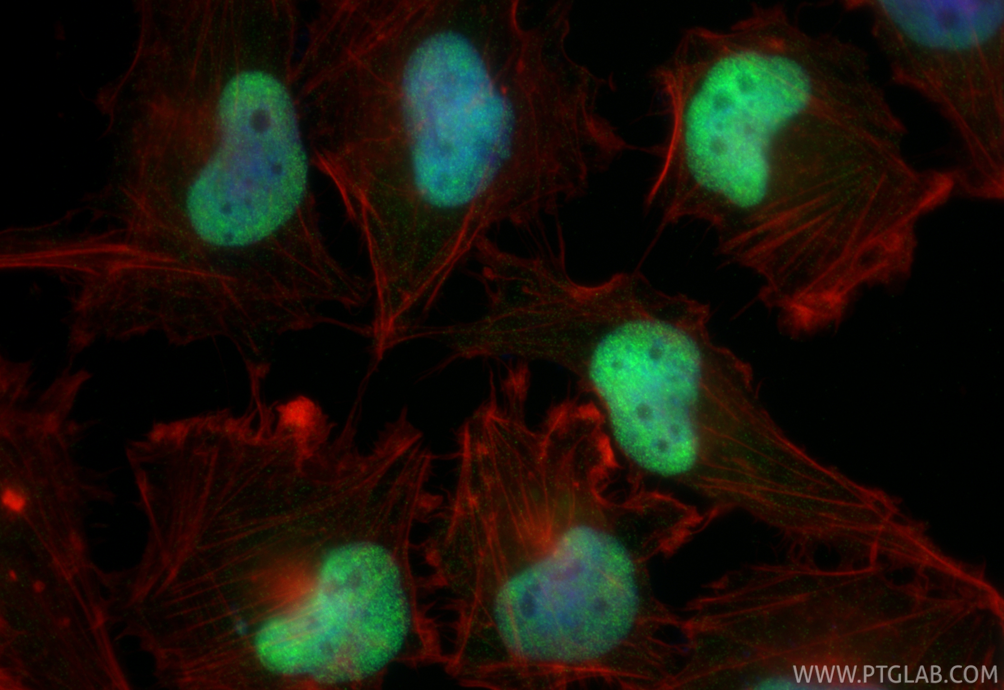 IF Staining of U-251 using 85930-1-RR