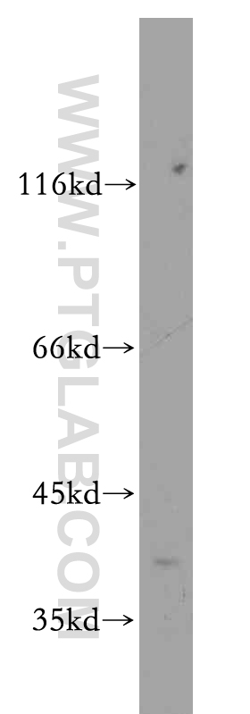 FOXH1-Specific Polyclonal antibody