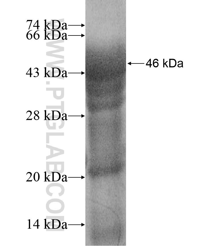 FOXJ3 fusion protein Ag17206 SDS-PAGE FOXJ3 fusion protein Ag17206 SDS-PAGE