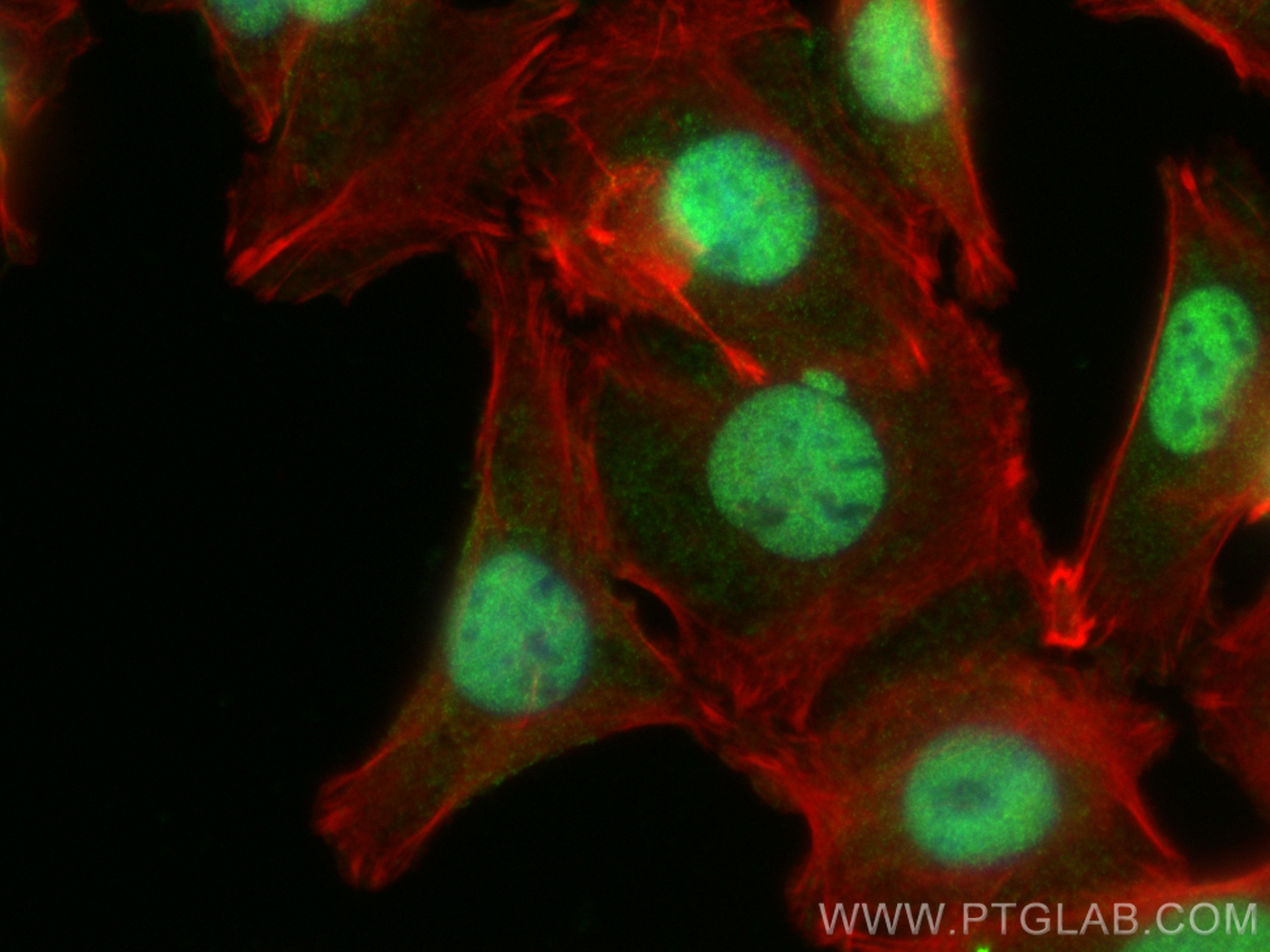IF Staining of SW480 using 29338-1-AP (same clone as 29338-1-PBS)