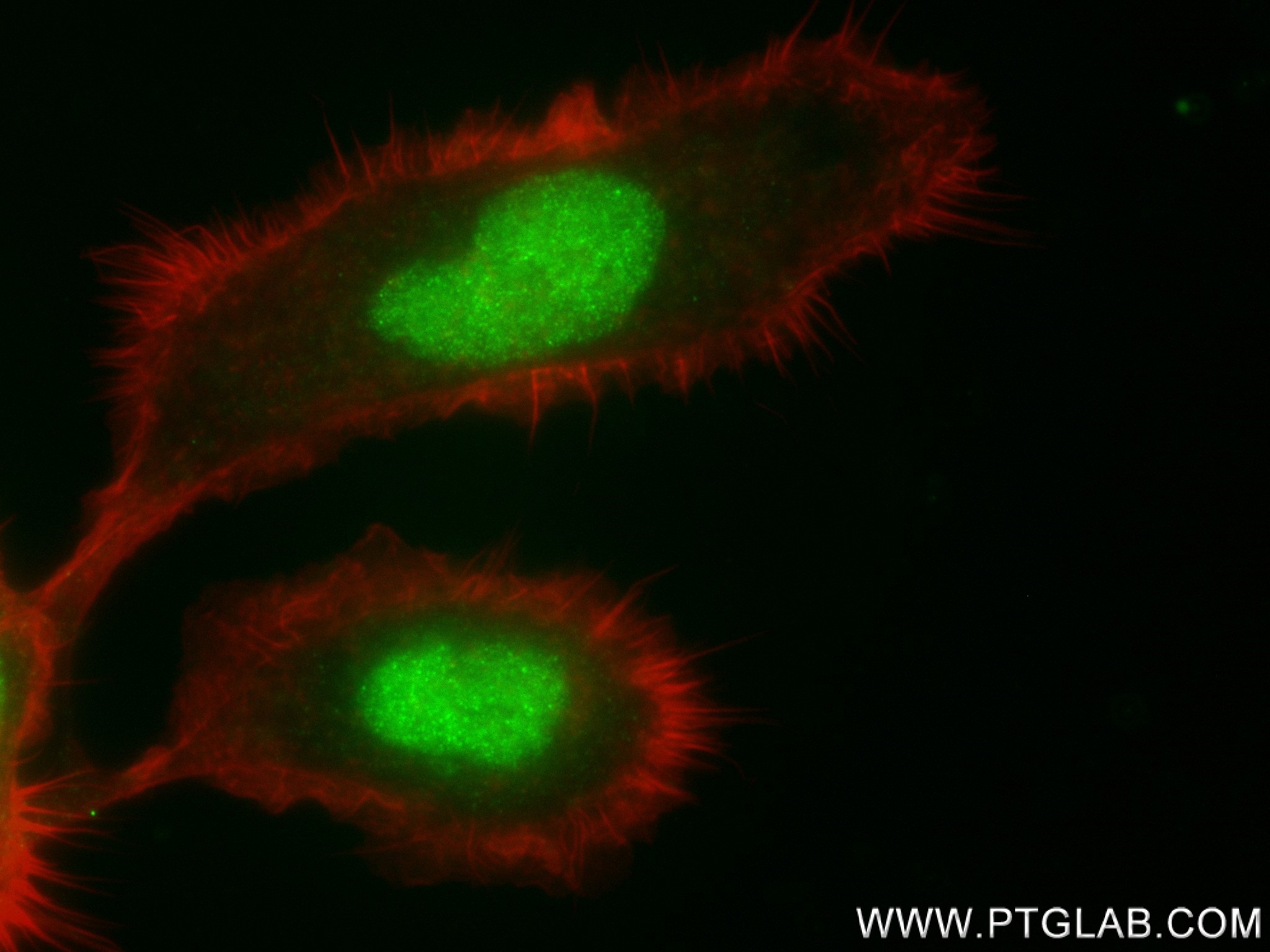 IF Staining of A431 using 83735-4-RR (same clone as 83735-4-PBS)