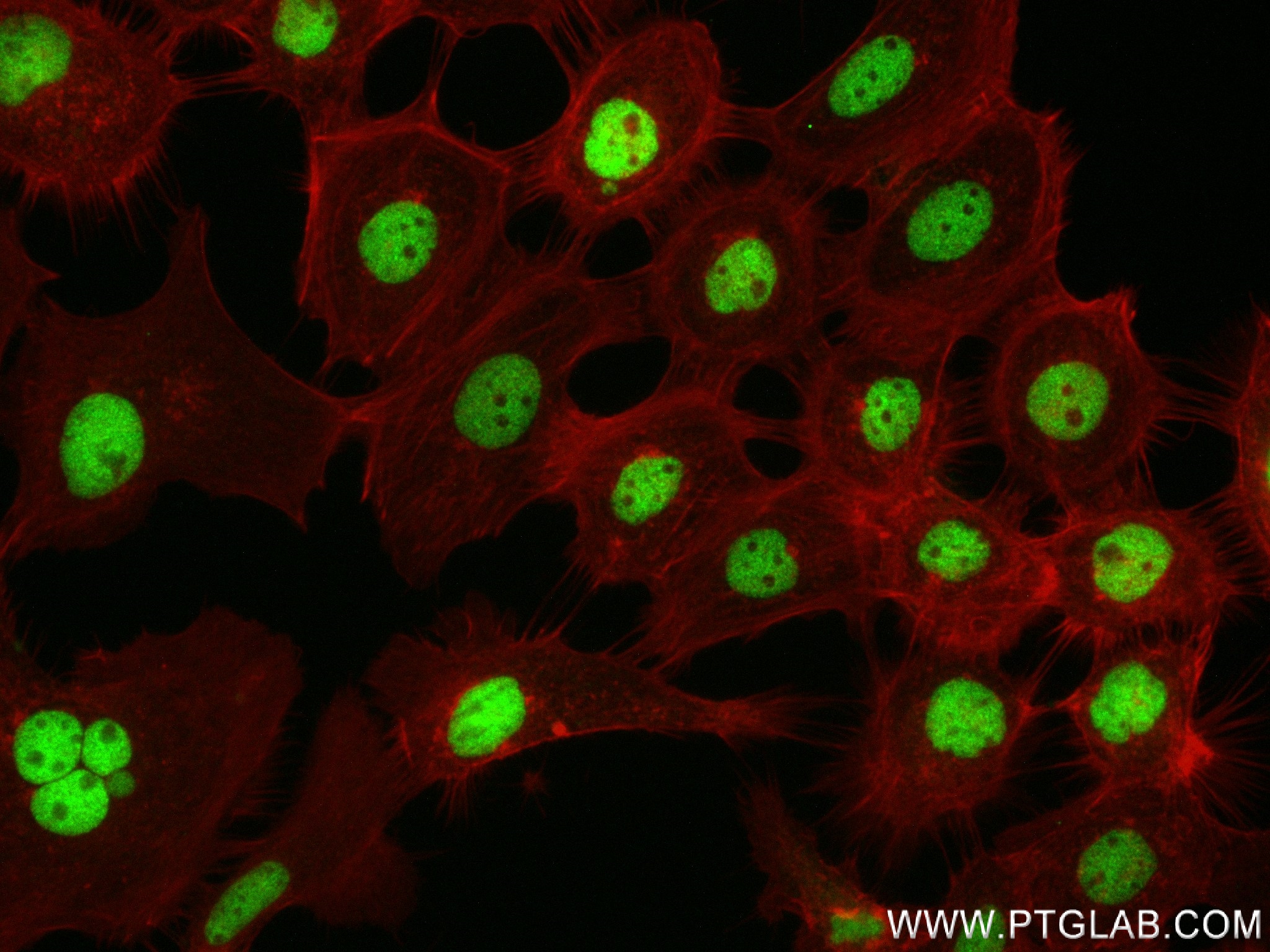 IF Staining of A431 using 83735-4-RR (same clone as 83735-4-PBS)