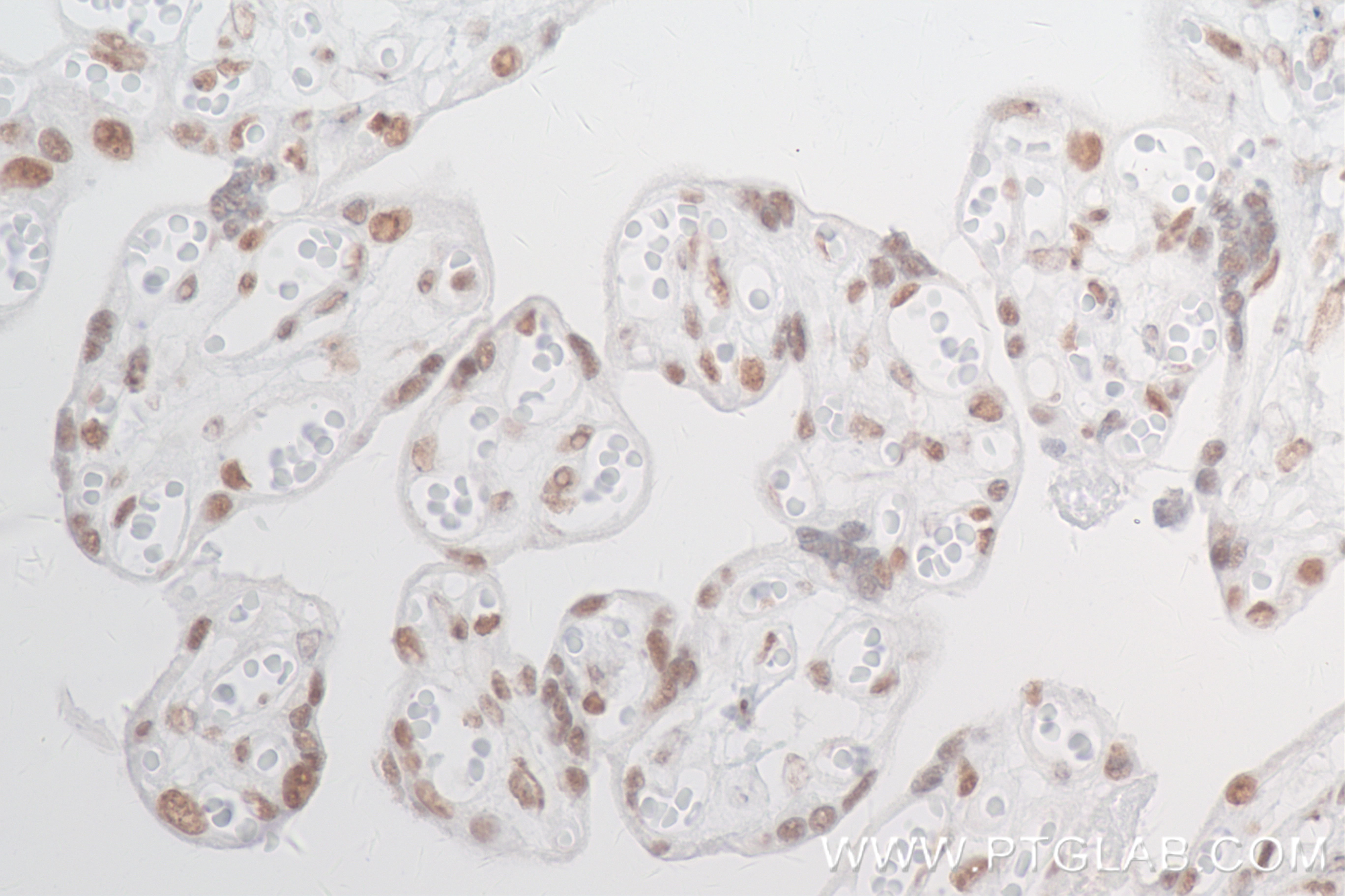 IHC staining of human placenta using 83735-6-RR