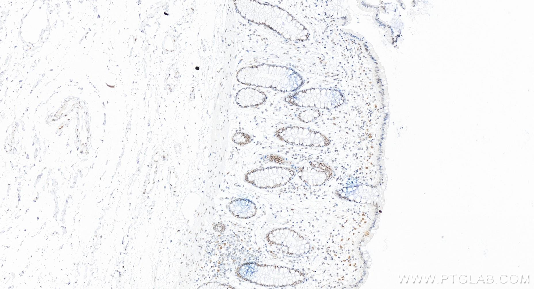 IHC staining of human colon using 83735-6-RR