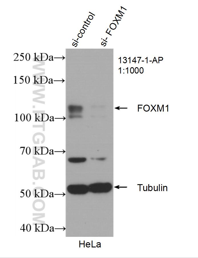 WB analysis of HeLa using 13147-1-AP