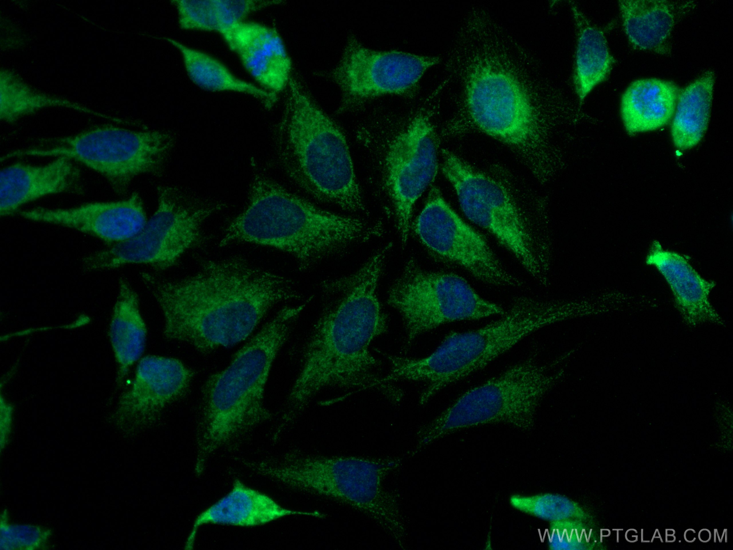 IF Staining of HeLa using 18592-1-AP (same clone as 18592-1-PBS)