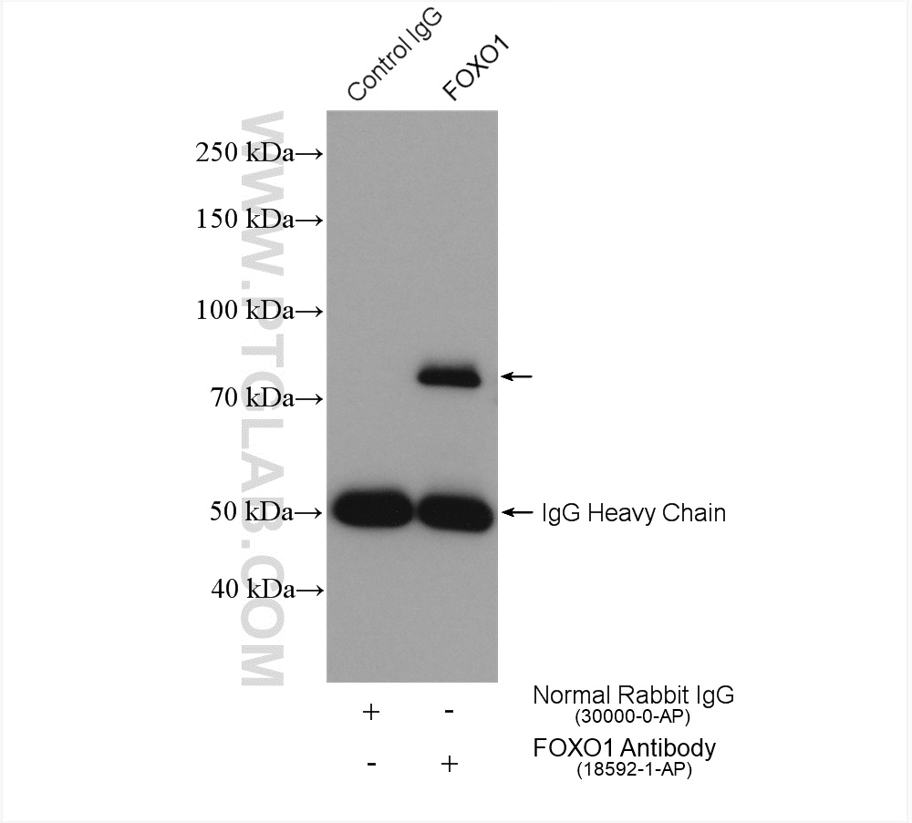 IP experiment of HepG2 using 18592-1-AP (same clone as 18592-1-PBS)