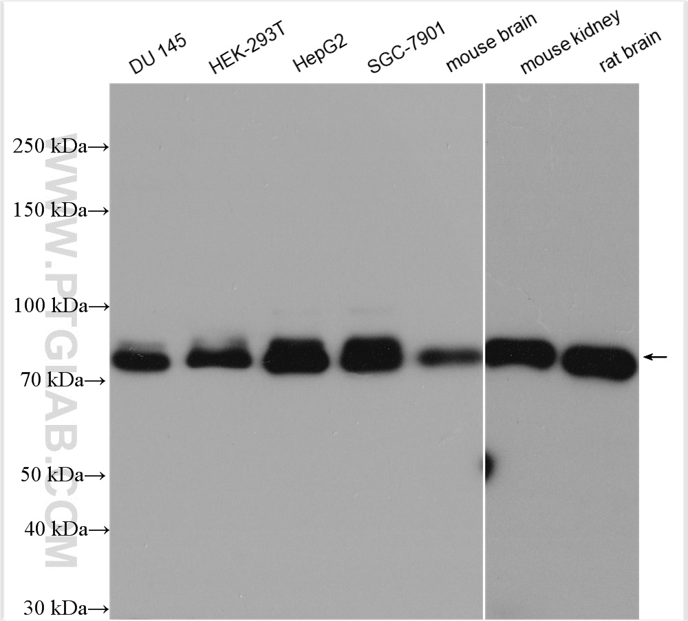 WB analysis using 18592-1-AP