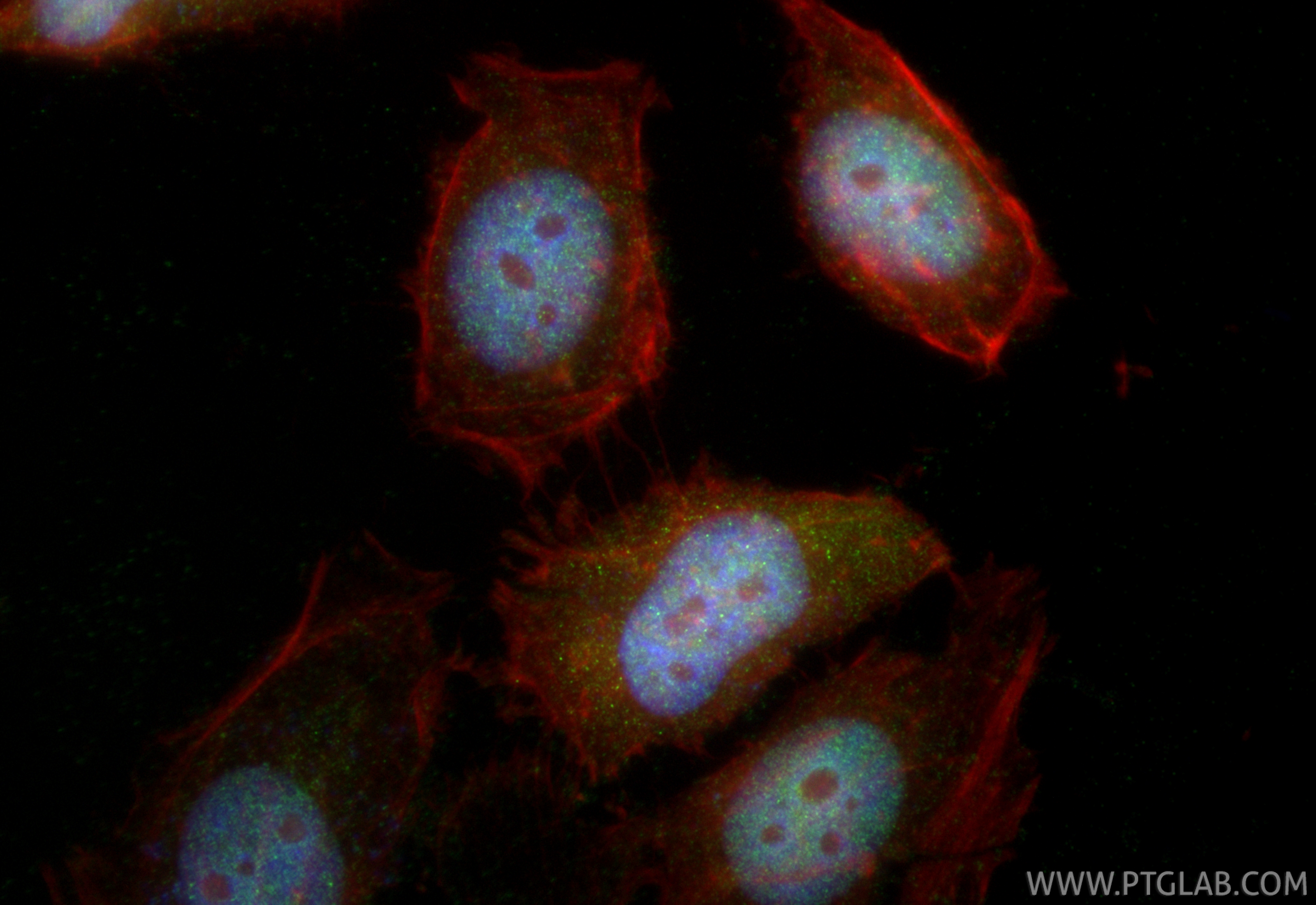 IF Staining of HeLa using 10849-1-AP IF Staining of HeLa using 10849-1-AP