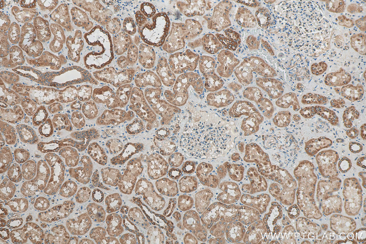 IHC staining of human kidney using 21535-1-AP