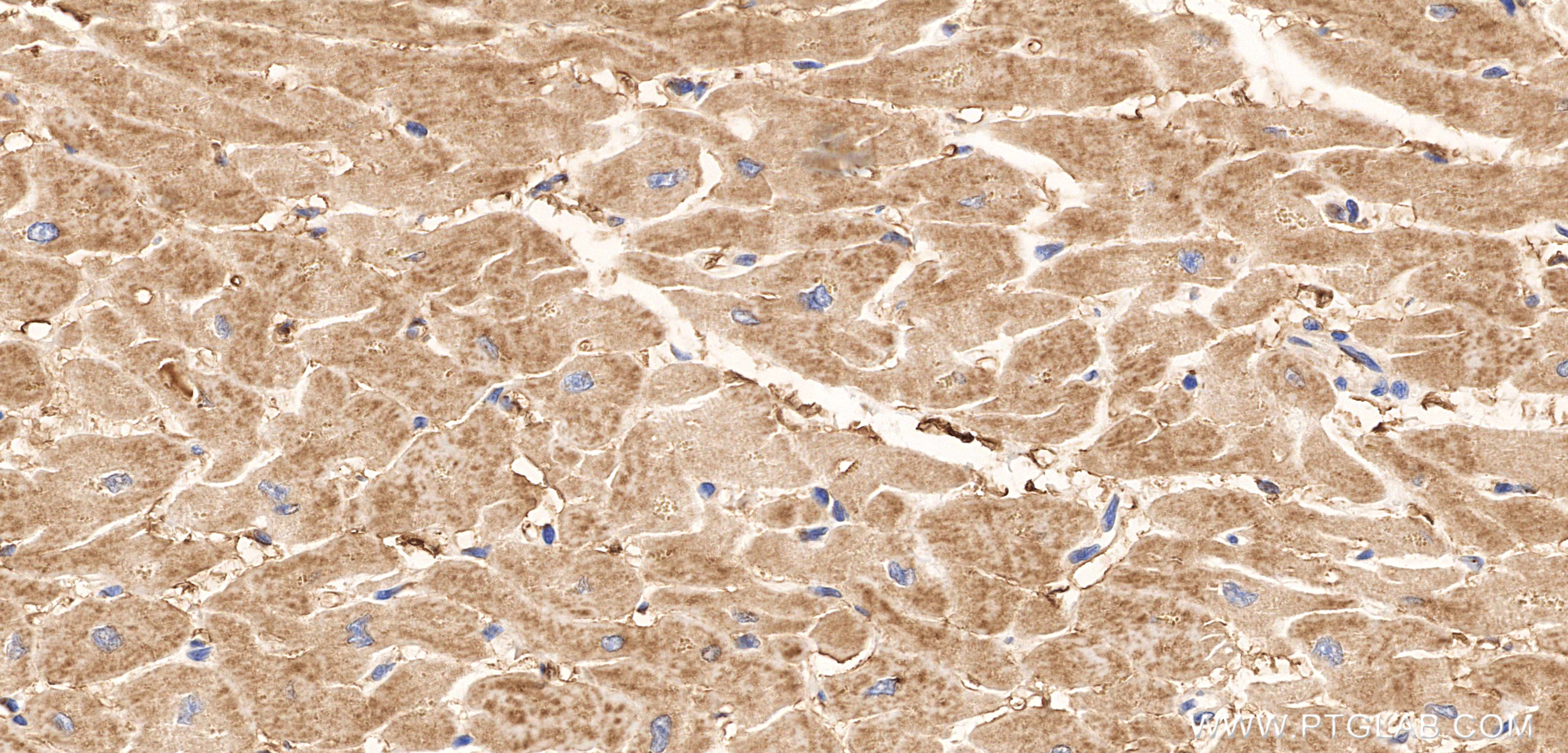 Immunohistochemical analysis of paraffin-embedded human heart tissue slide using 86236-1-RR (FOXO4 antibody) at dilution of 1:1000 (under 40x lens). Heat mediated antigen retrieval with Tris-EDTA buffer (pH 9.0). IHC staining of human heart using 86236-1-RR