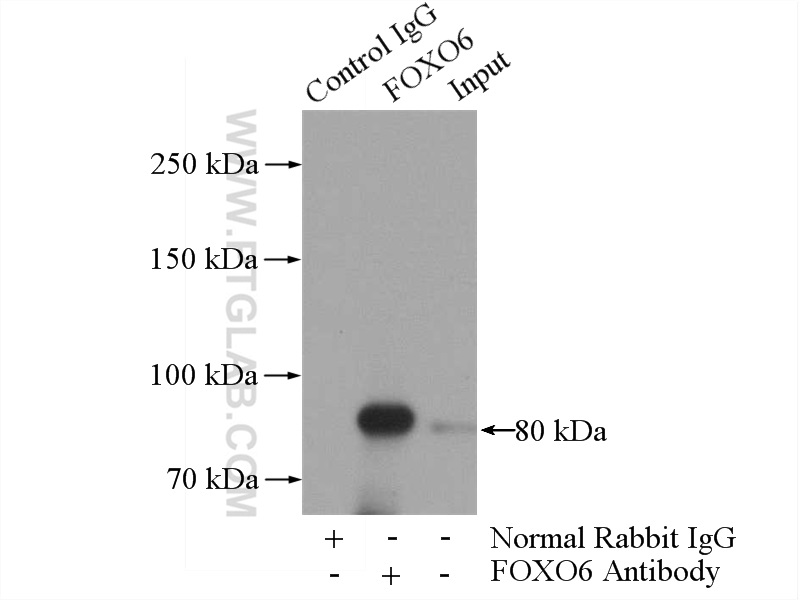 IP experiment of mouse brain using 19122-1-AP