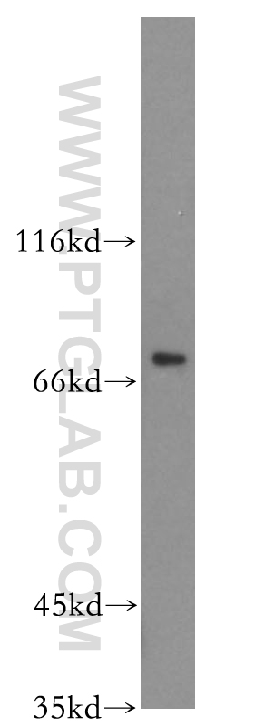 WB analysis of mouse brain using 19122-1-AP