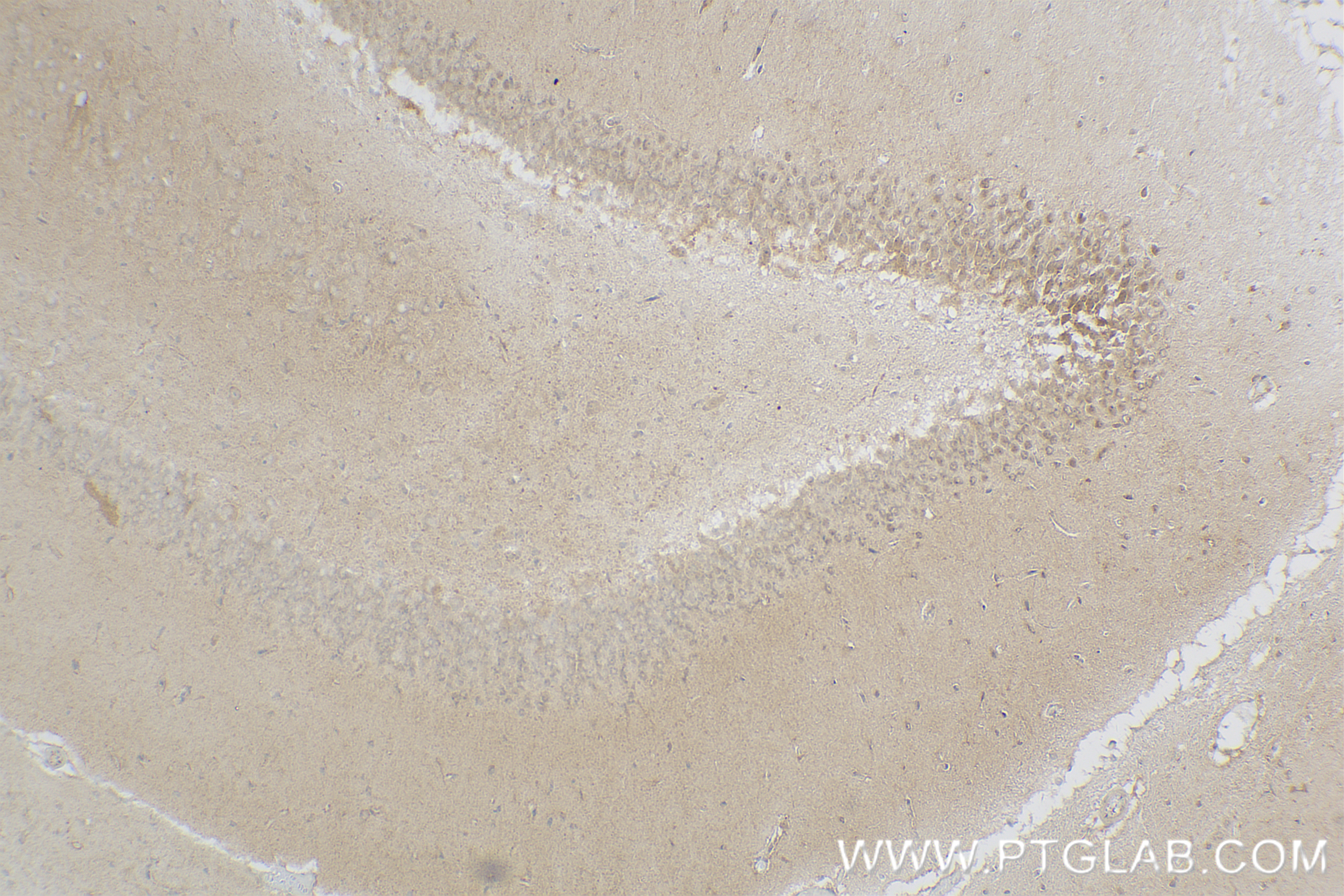 IHC staining of rat brain using 83926-1-RR