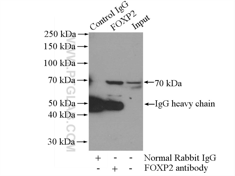 IP experiment of mouse spleen using 20529-1-AP