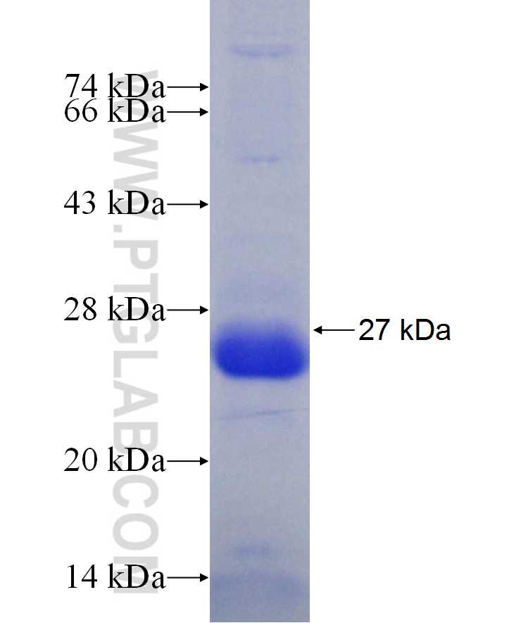 FOXP2 fusion protein Ag29855 SDS-PAGE FOXP2 fusion protein Ag29855 SDS-PAGE
