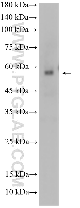 A375 cells were subjected to SDS PAGE followed by western blot with 22228-1-AP (FOXP3 antibody) at dilution of 1:2000 incubated at room temperature for 1.5 hours. WB analysis of A375 using 22228-1-AP