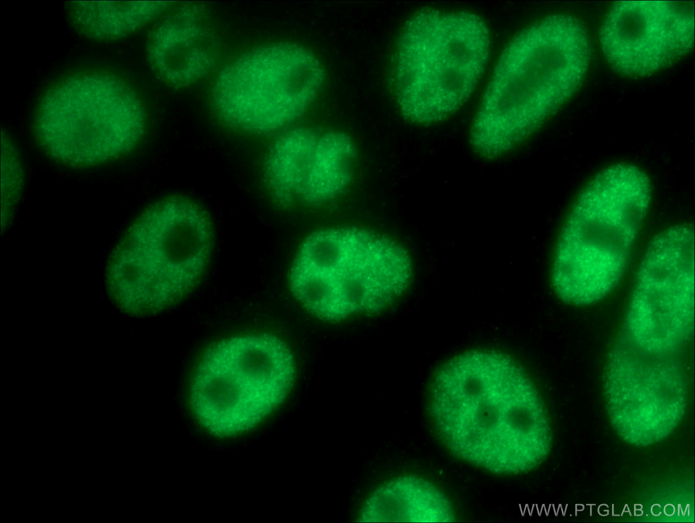 IF Staining of HepG2 using 16772-1-AP