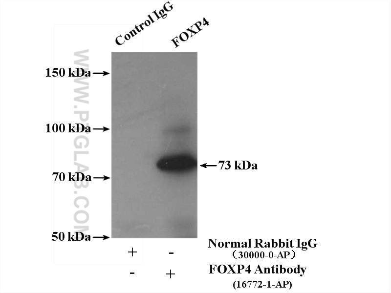 IP experiment of mouse lung using 16772-1-AP