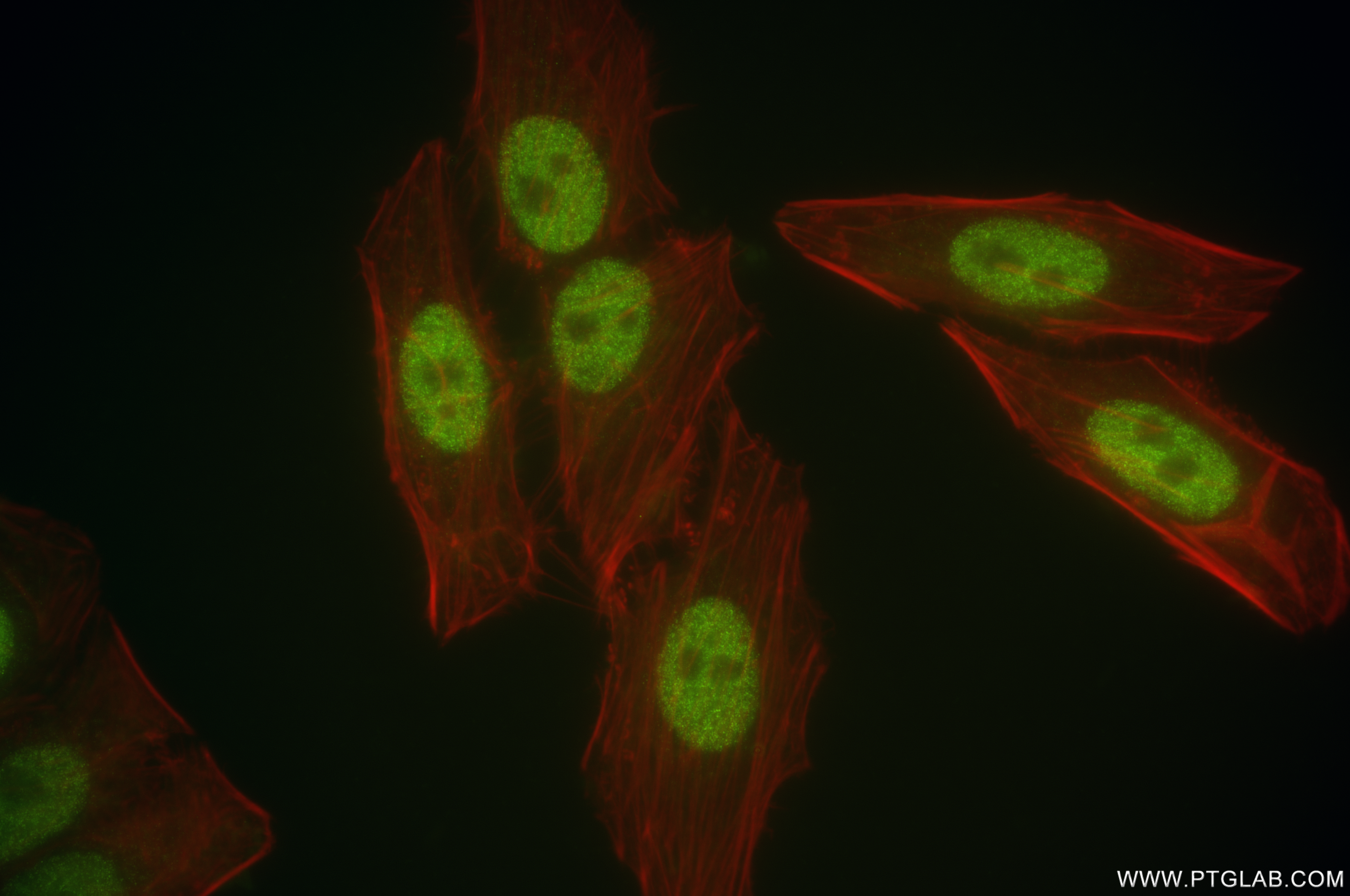 IF Staining of HepG2 using 84855-1-RR (same clone as 84855-1-PBS)