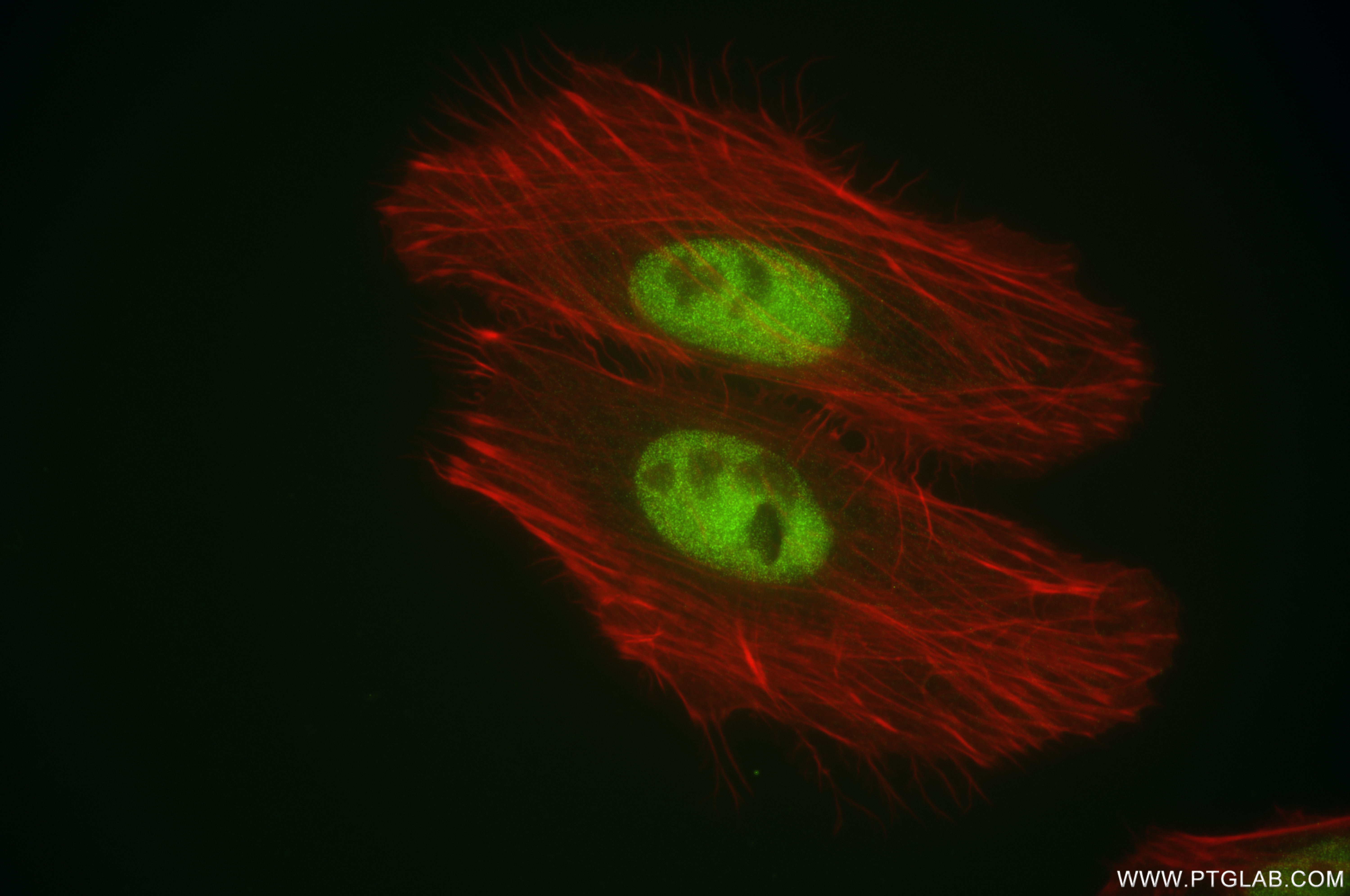 IF Staining of HeLa using 84855-1-RR (same clone as 84855-1-PBS)