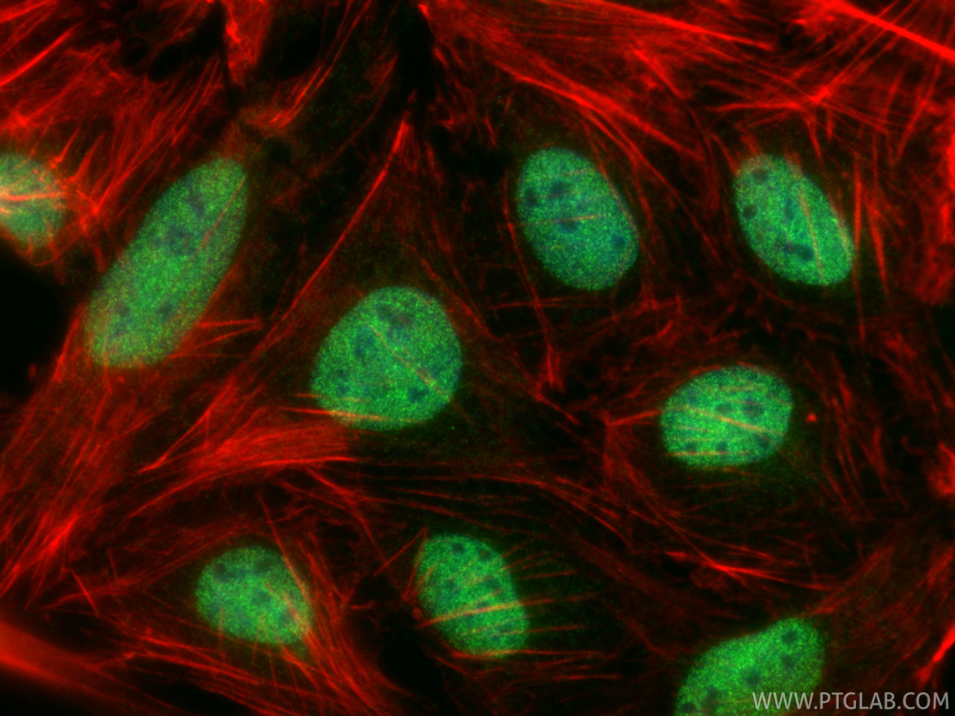 IF Staining of U2OS using 84855-1-RR (same clone as 84855-1-PBS) IF Staining of U2OS using 84855-1-RR (same clone as 84855-1-PBS)