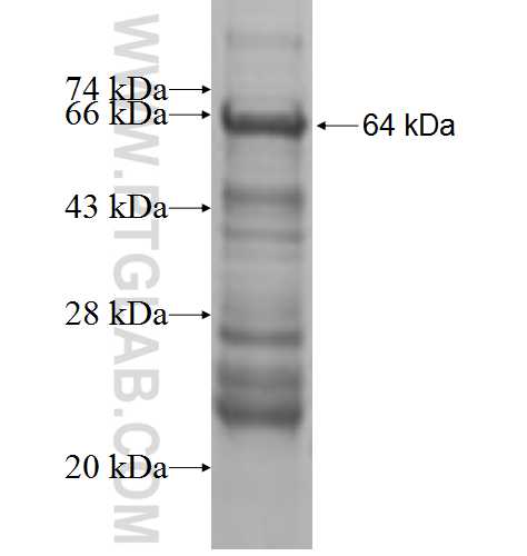 FOXP4 fusion protein Ag10034 SDS-PAGE FOXP4 fusion protein Ag10034 SDS-PAGE