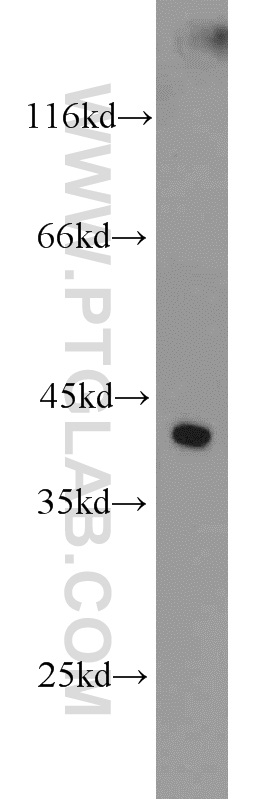 WB analysis of mouse kidney using 23718-1-AP