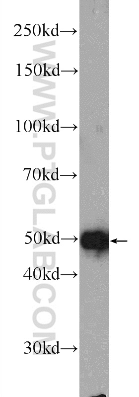 WB analysis of HeLa using 24595-1-AP