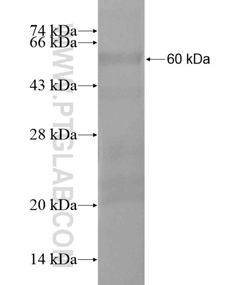 FOXRED1 fusion protein Ag20075 SDS-PAGE FOXRED1 fusion protein Ag20075 SDS-PAGE