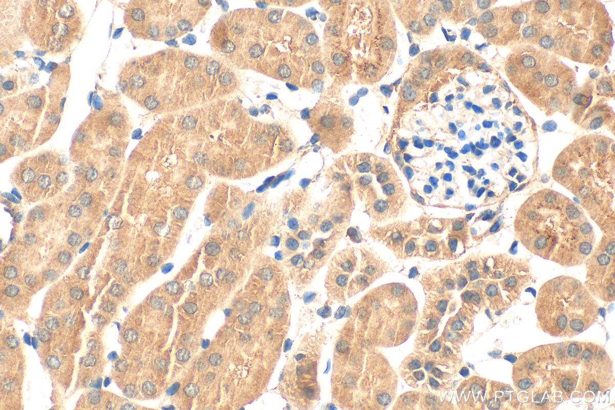 IHC staining of mouse kidney using 27616-1-AP