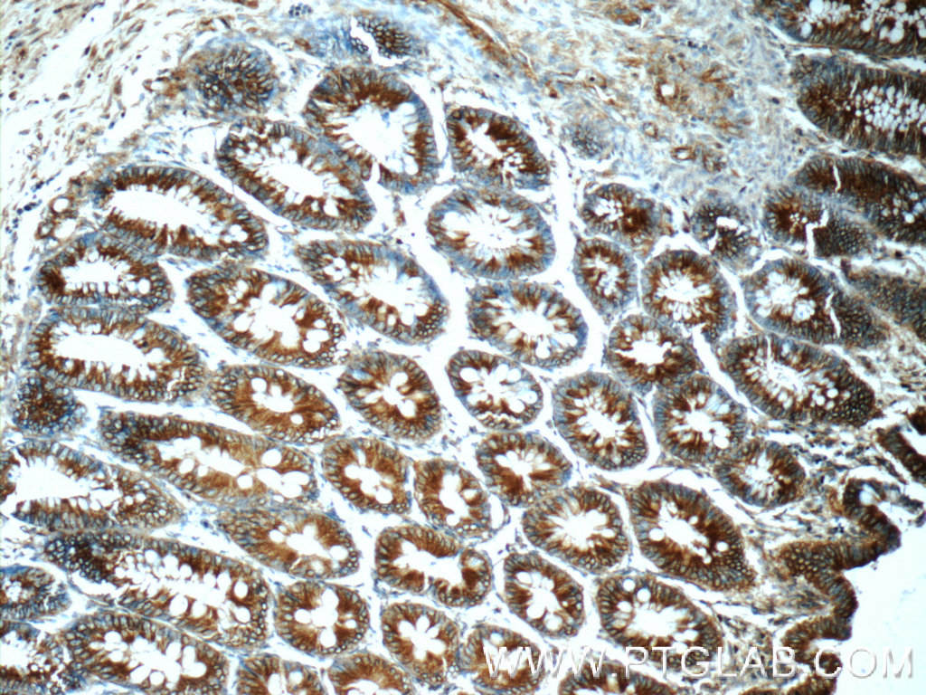 IHC staining of human colon using 24937-1-AP (same clone as 24937-1-PBS)