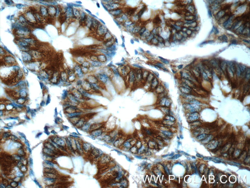 IHC staining of human colon using 24937-1-AP (same clone as 24937-1-PBS)