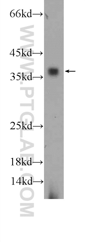 WB analysis of mouse colon using 24937-1-AP (same clone as 24937-1-PBS)