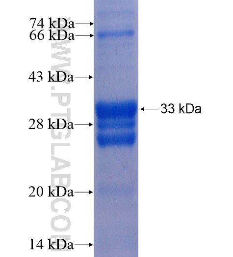 FPR1 fusion protein Ag14063 SDS-PAGE FPR1 fusion protein Ag14063 SDS-PAGE