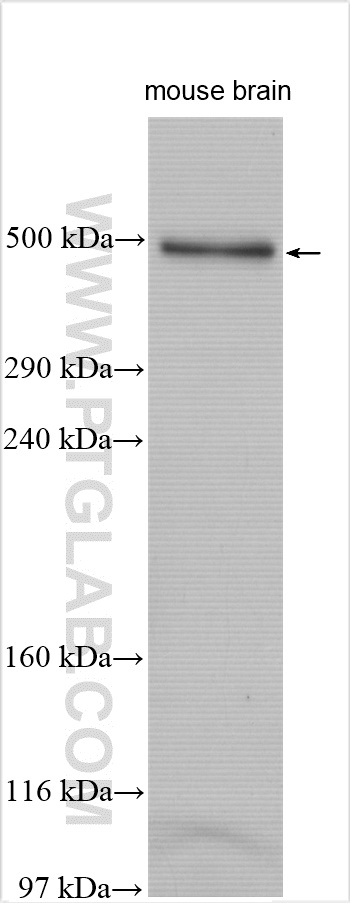 mouse brain tissue were subjected to Tris-Acetate gel system followed by western blot with 29654-1-AP (FRAS1 antibody) at dilution of 1:1000 incubated at room temperature for 1.5 hours. WB analysis of mouse brain using 29654-1-AP