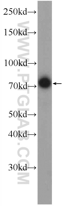 WB analysis of HepG2 using 13086-1-AP