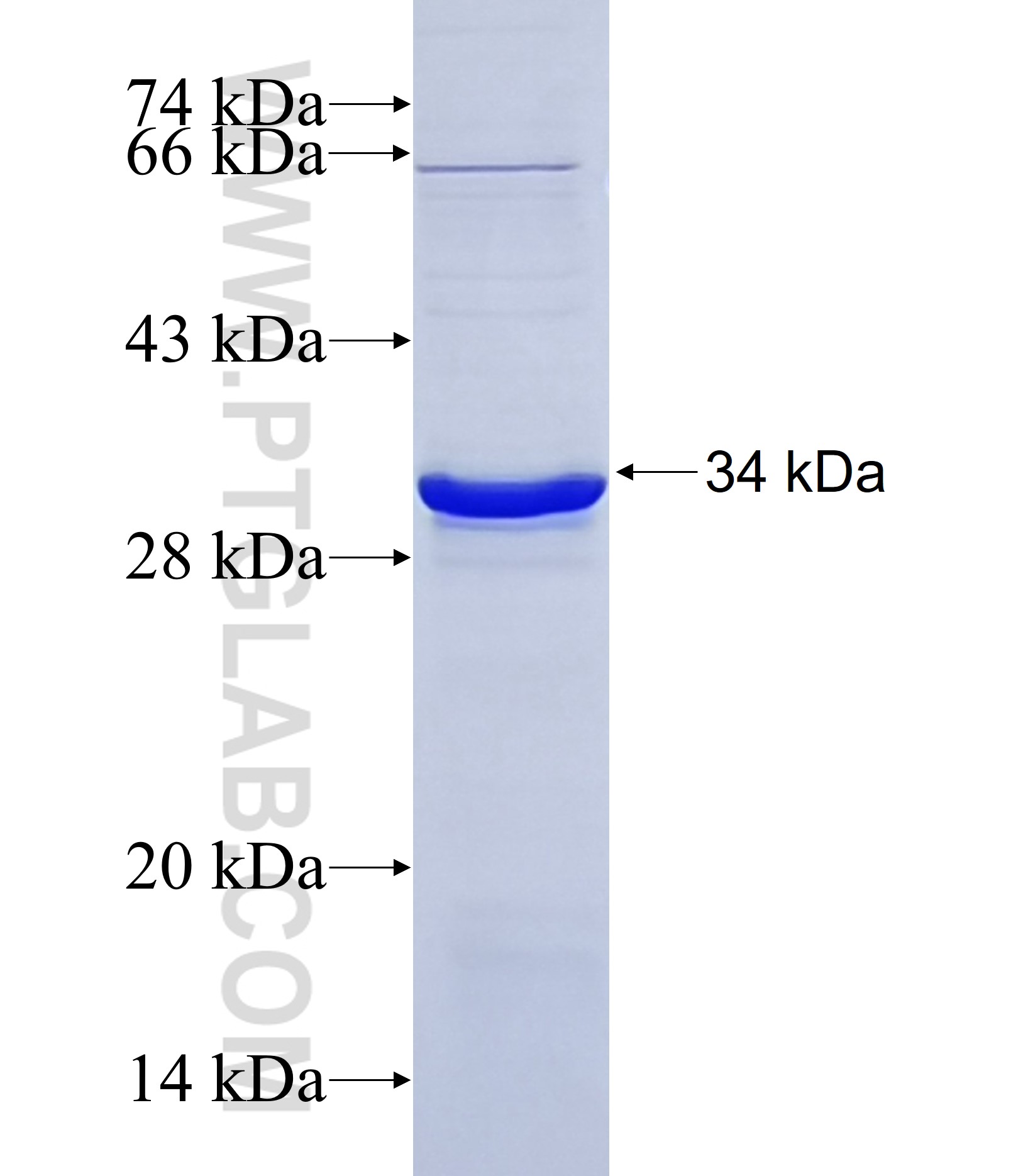 FREM2 fusion protein Ag37152 SDS-PAGE FREM2 fusion protein Ag37152 SDS-PAGE