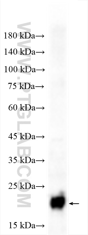 mouse brain tissue were subjected to SDS PAGE followed by western blot with 10506-2-AP (NCS1 antibody) at dilution of 1:4000 incubated at room temperature for 1.5 hours. WB analysis of mouse brain using 10506-2-AP