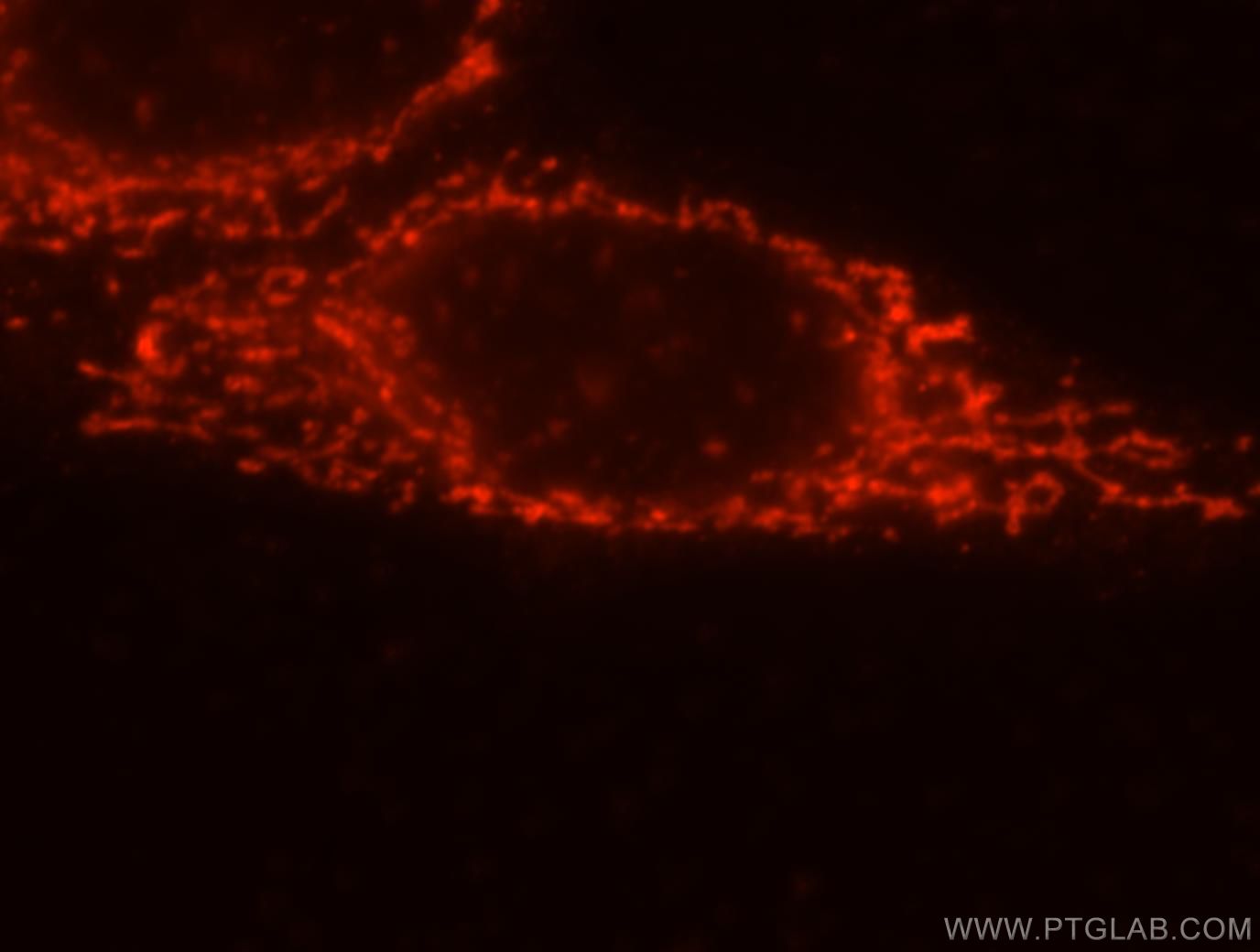 IF Staining of HepG2 using 16197-1-AP