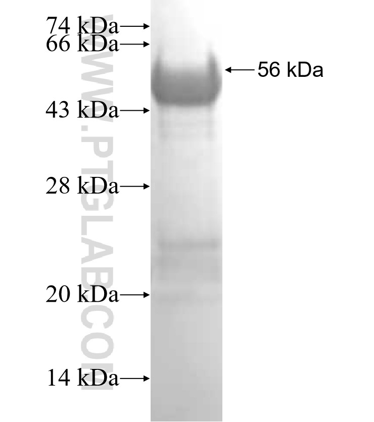 FRK fusion protein Ag0510 SDS-PAGE FRK fusion protein Ag0510 SDS-PAGE