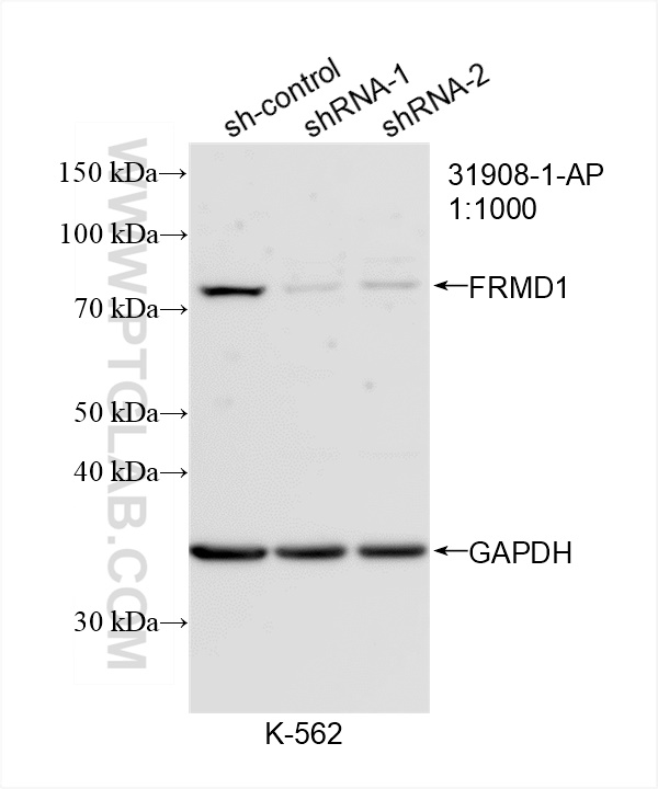 WB analysis of K-562 using 31908-1-AP