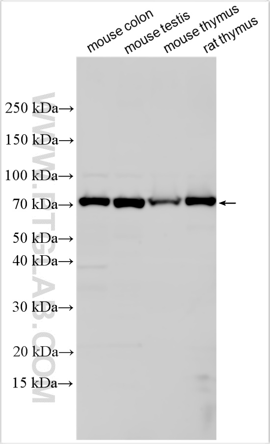 WB analysis using 31908-1-AP
