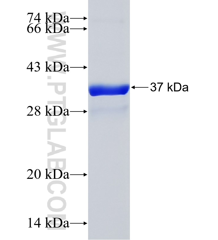FRMD1 fusion protein Ag36382 SDS-PAGE