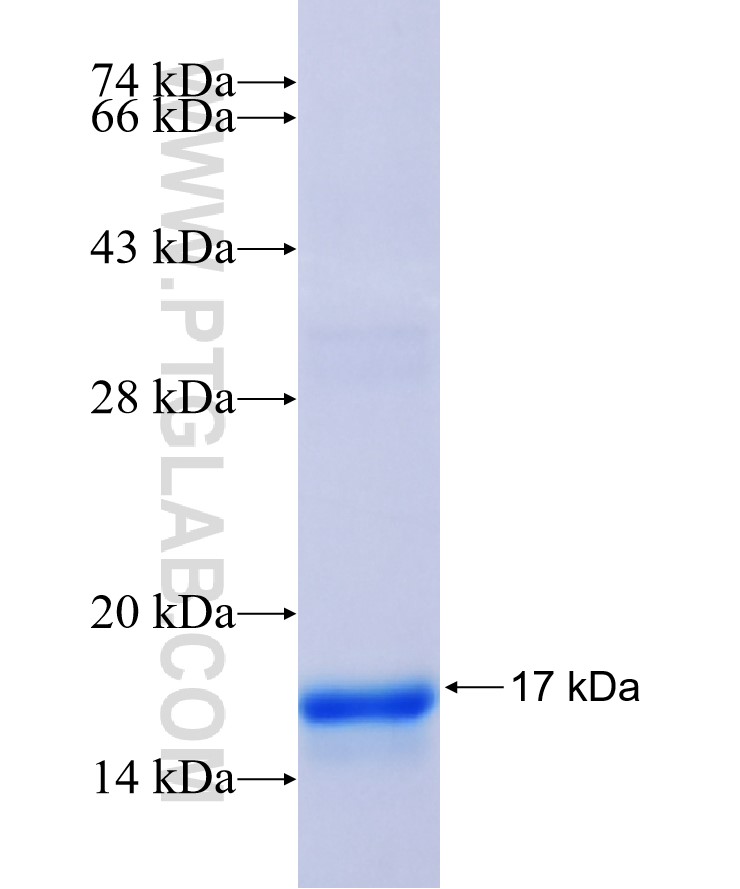 FRMD1 fusion protein Ag36443 SDS-PAGE