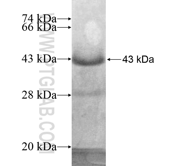 FRMD3 fusion protein Ag13230 SDS-PAGE FRMD3 fusion protein Ag13230 SDS-PAGE